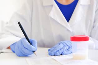 So wird Mann Samenspender Der Reproduktionsmediziner Gideon Sartorius erklärt, wie ein Mann Samenspender wird